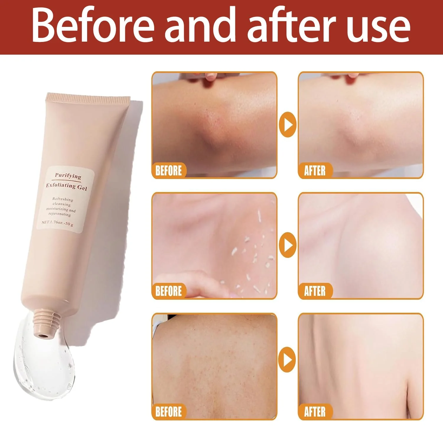 ClearSkin Exfoliating Gel - Radiant Skin in 1 minute - Image 5