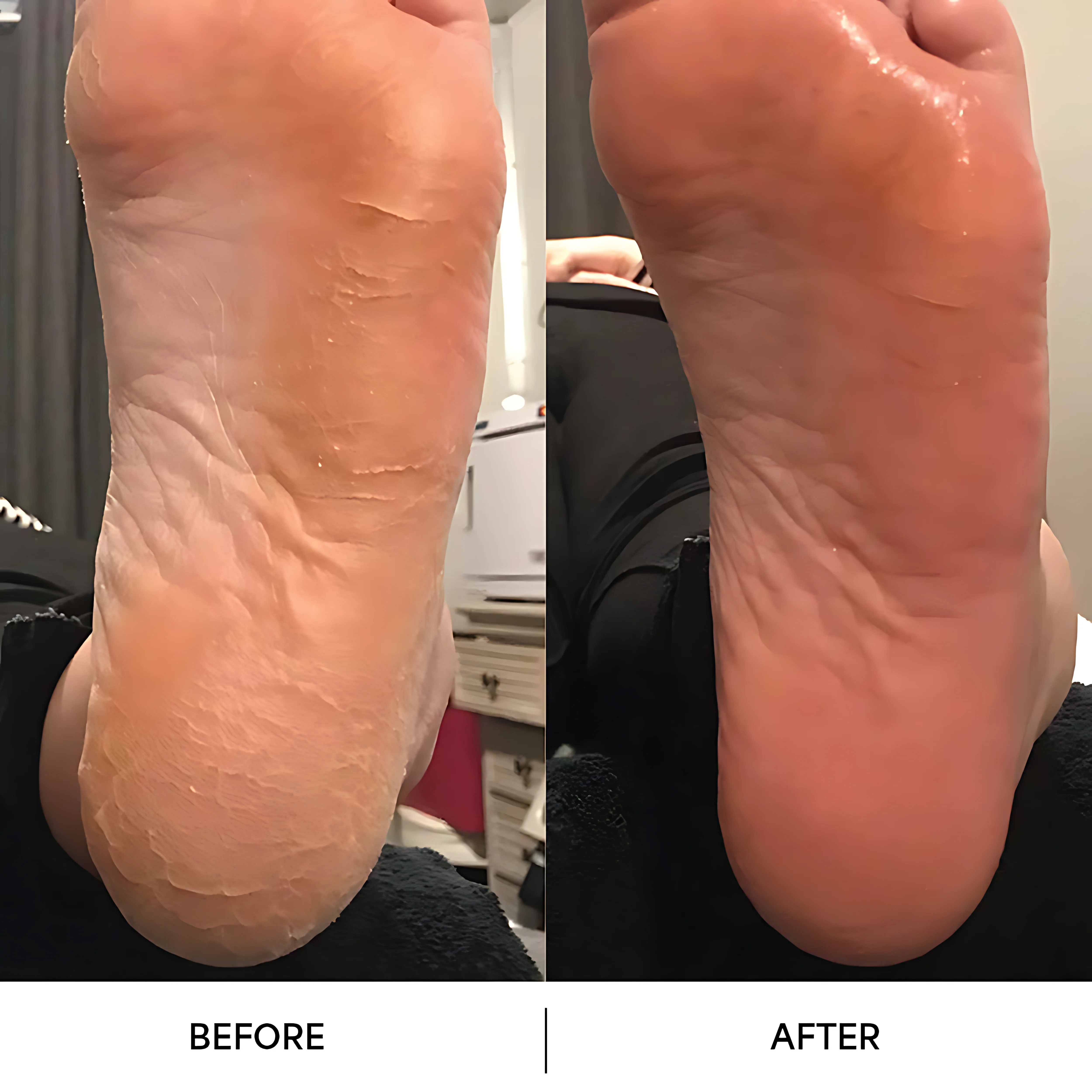 Dermave™ Electric Foot File – Smooth, Spa-Perfect Feet at Home - Image 4