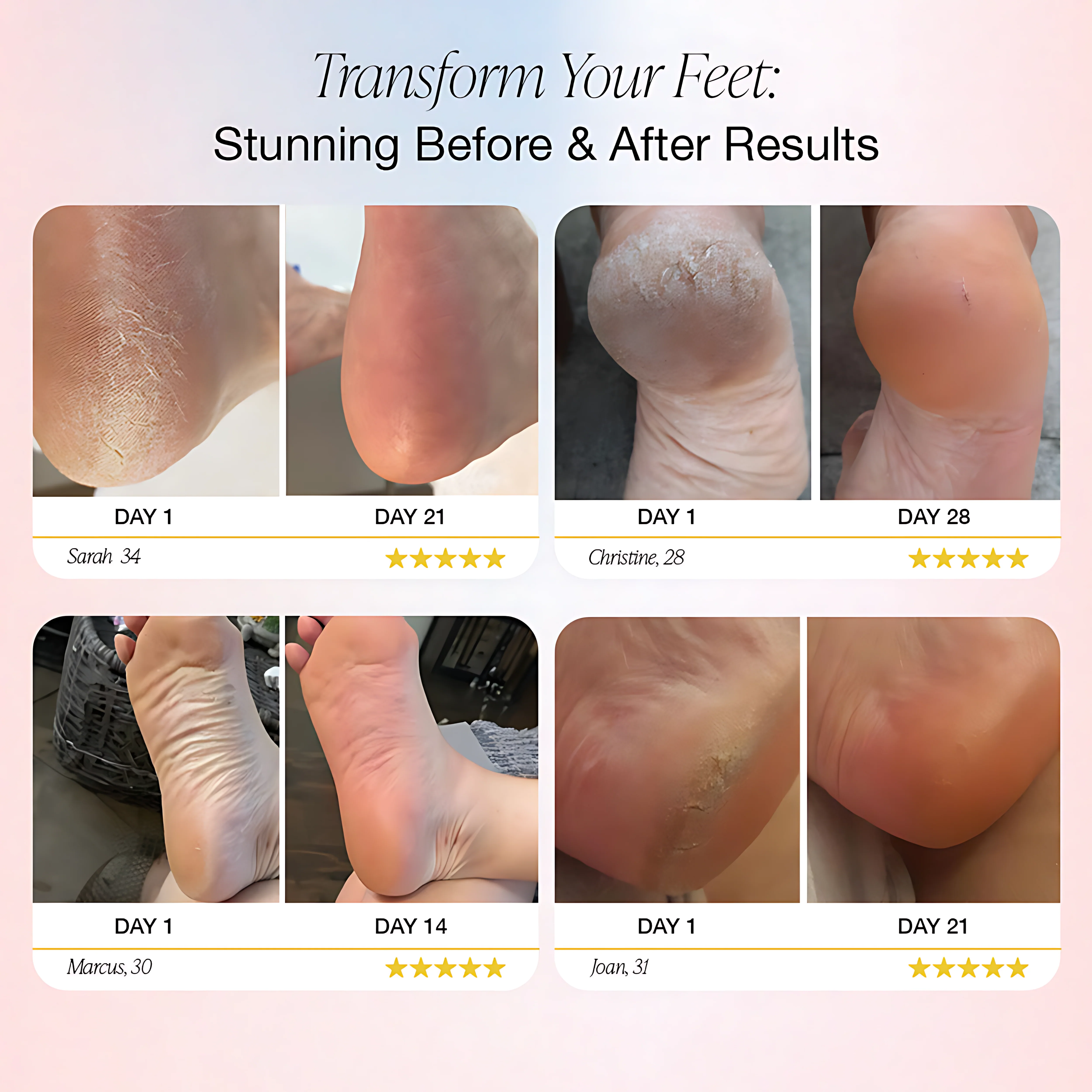 Dermave™ Electric Foot File – Smooth, Spa-Perfect Feet at Home - Image 9