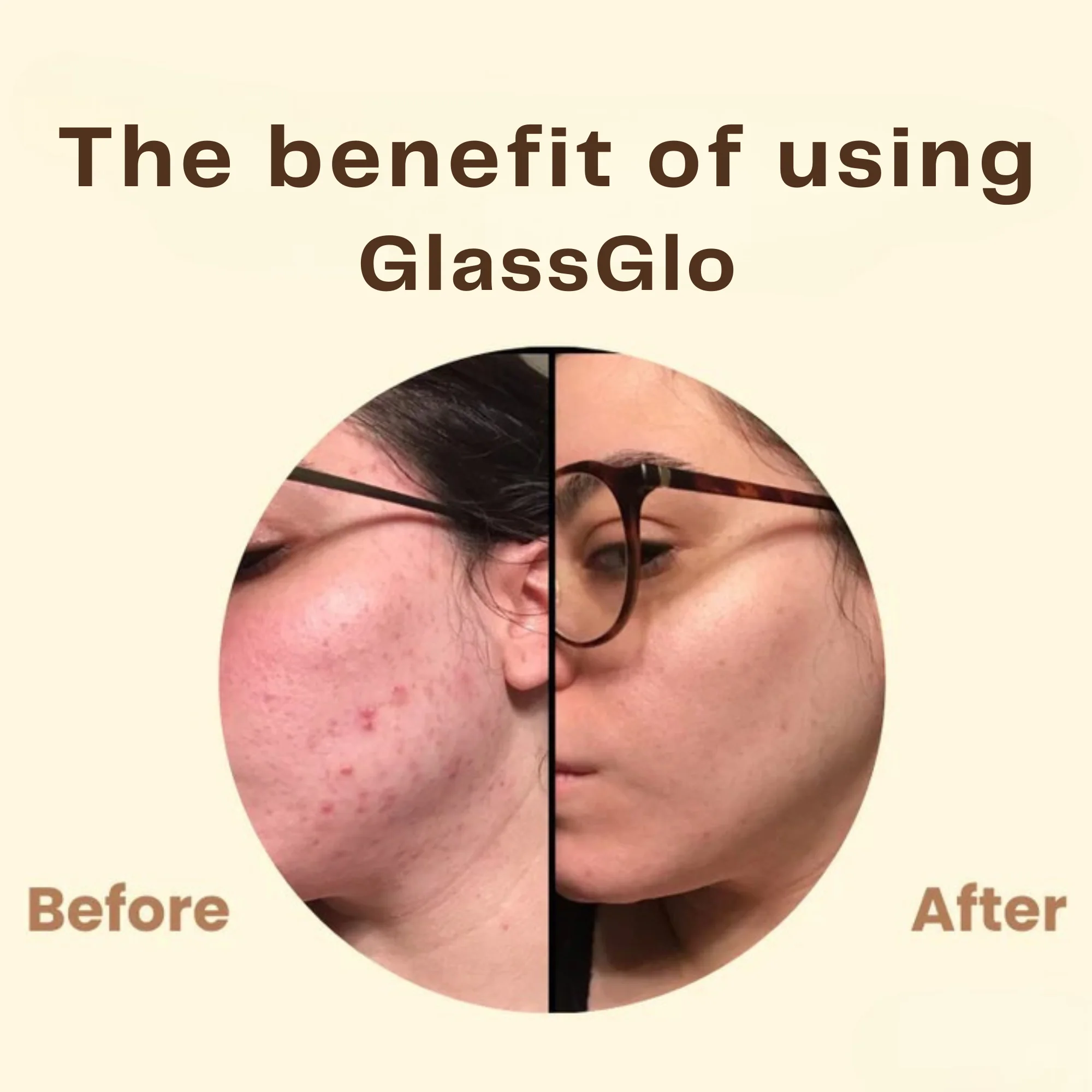 GlassGlo™ - Deep Purifying Peel-Off Mask - Image 4