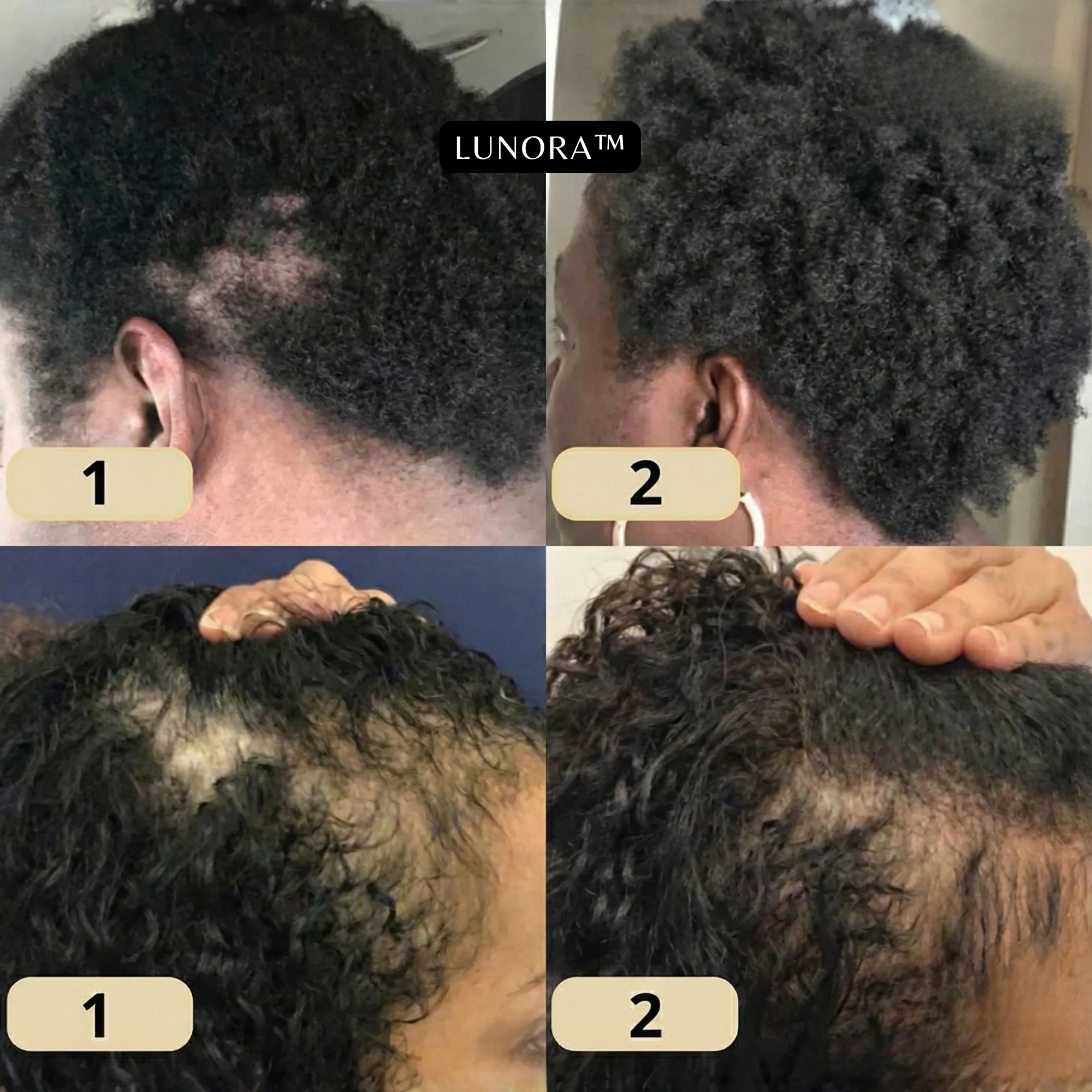 LUNORA™ Veganic Hair Growth Oil - Image 4