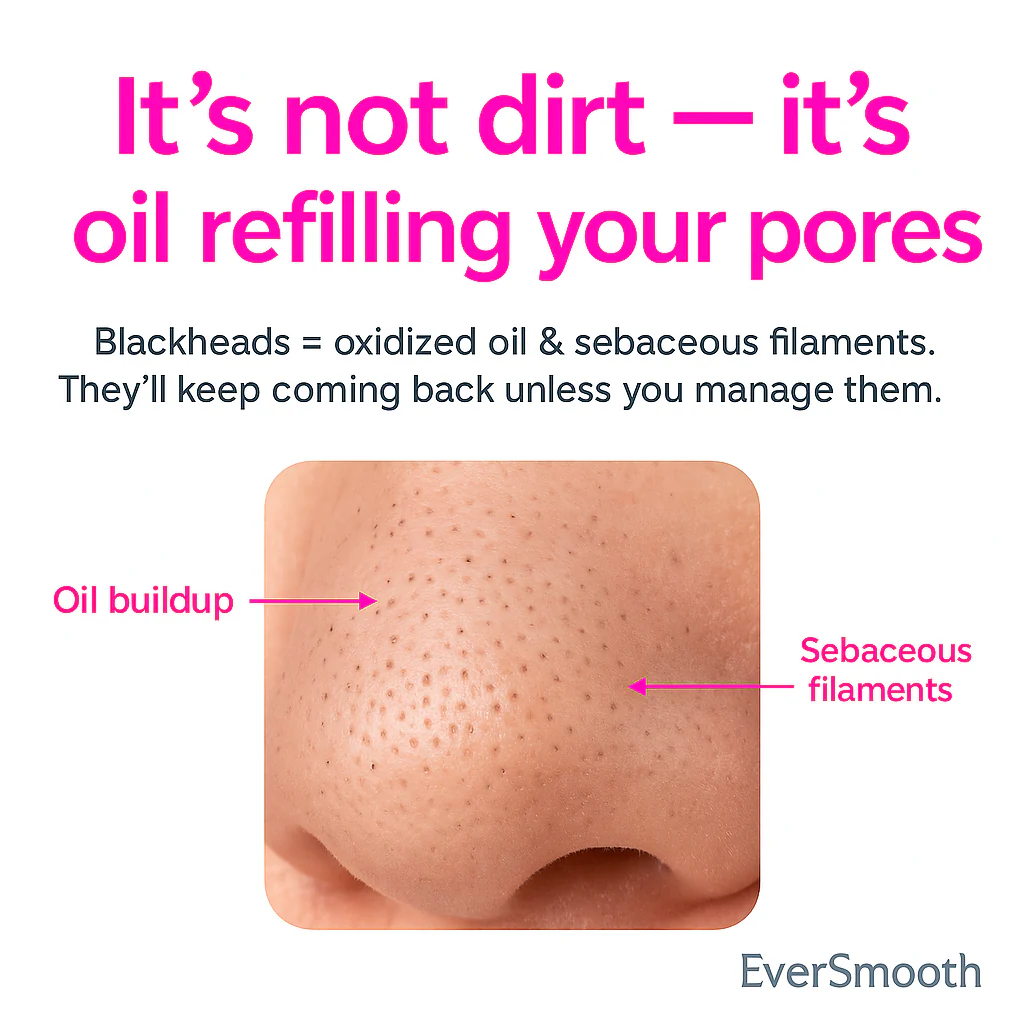 Pore Vacuum Pro™ – Reveal Your Smooth, Radiant Skin Instantly - Image 2
