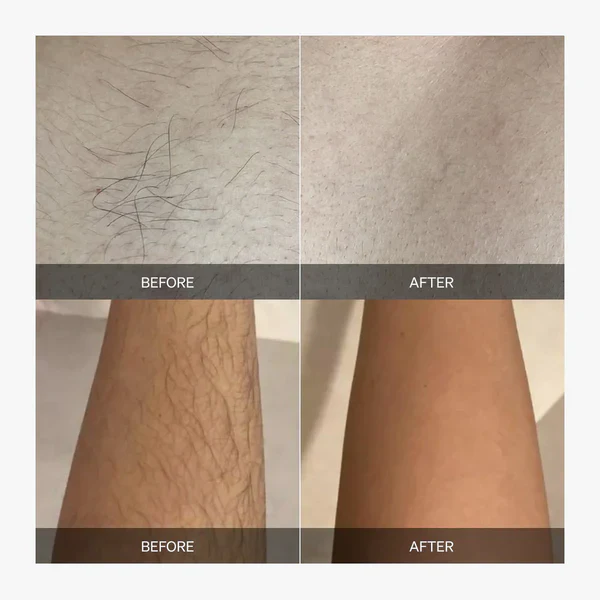 SmoothBeam - Full-Body Smoothness, Zero Irritation - Image 10