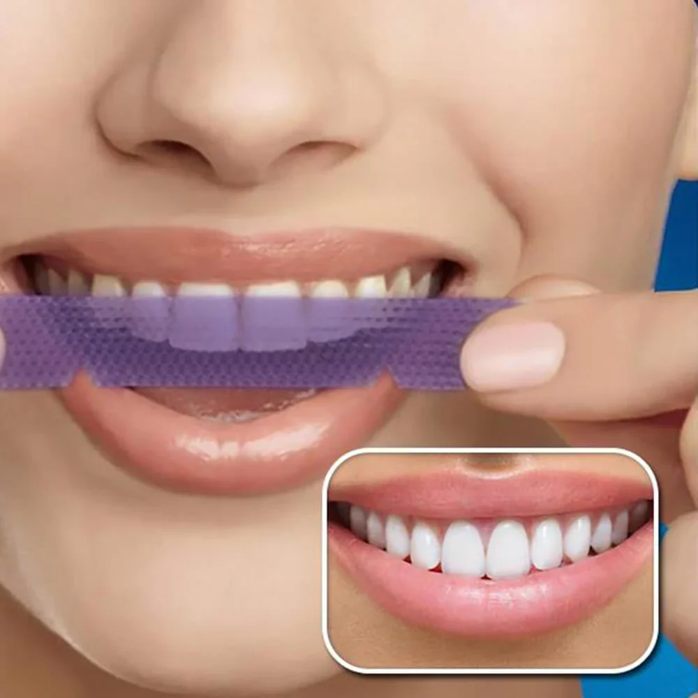 Teeth Whitening White Strips - Image 5