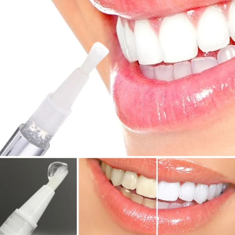 Teeth Whitening Pen - Radiant smile in 10 minutes - Image 5